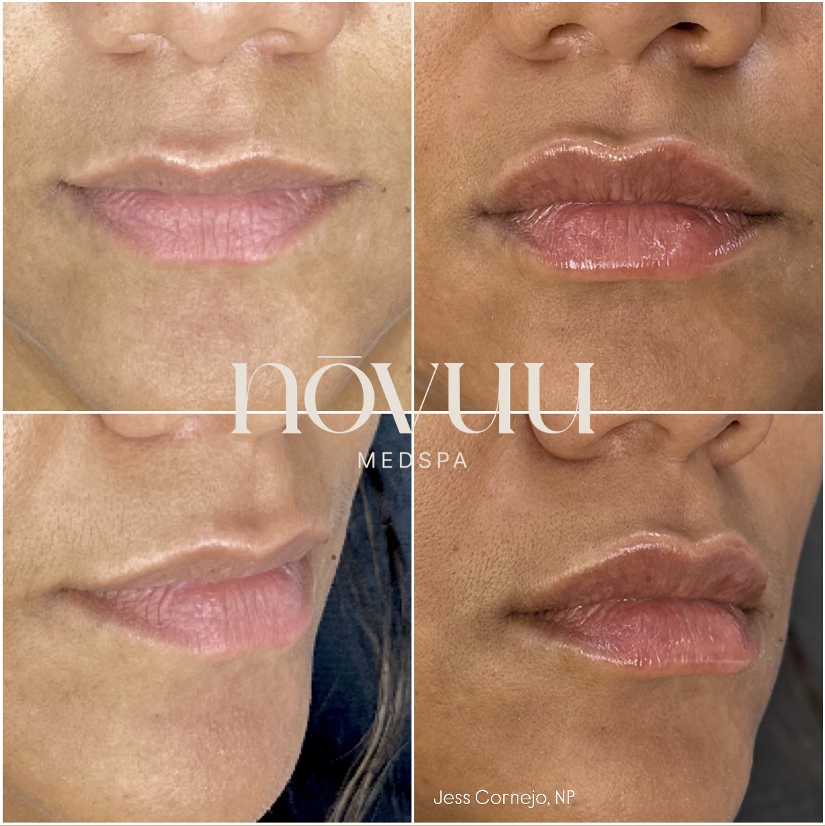 73B6A999-D0C0-44A6-A11B-FAE6CE46CEEC