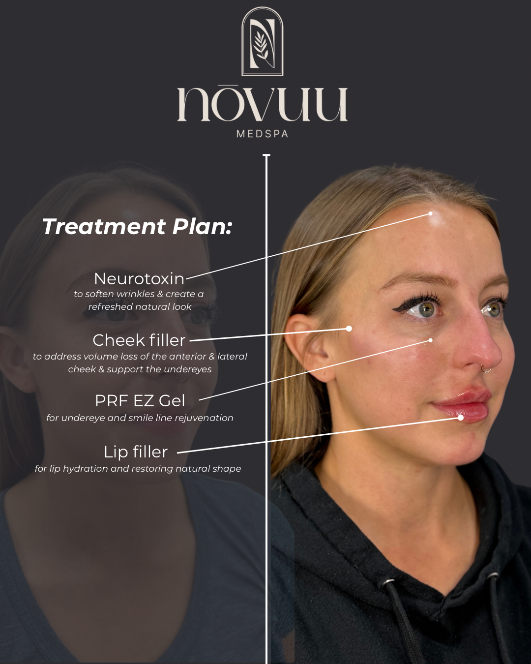 Copy of Medical weight loss - 10