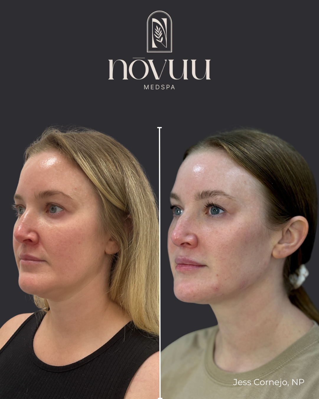 Copy of Medical weight loss 2