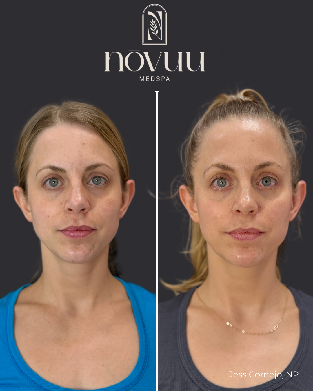 Copy of Medical weight loss - 21