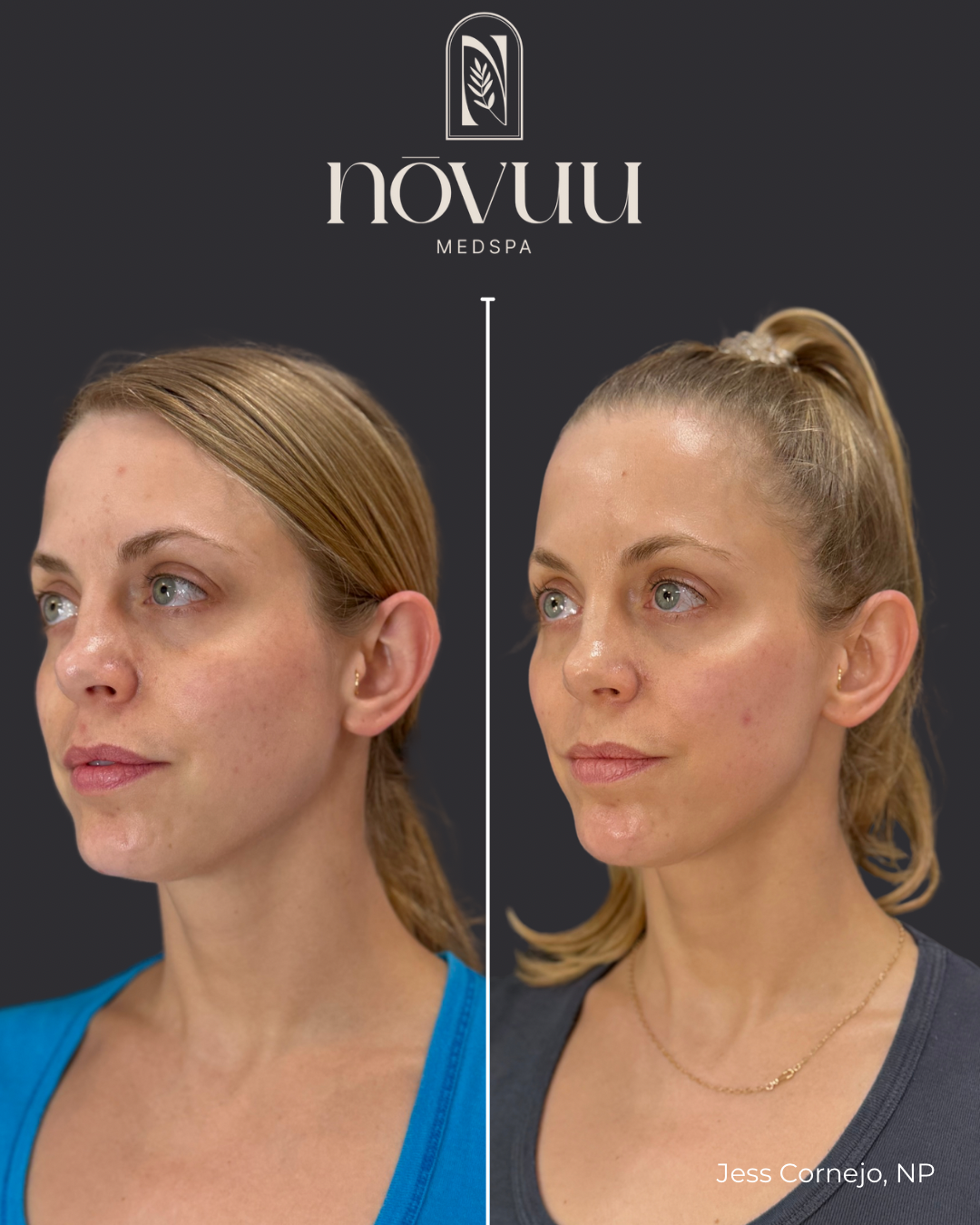 Copy of Medical weight loss - 23