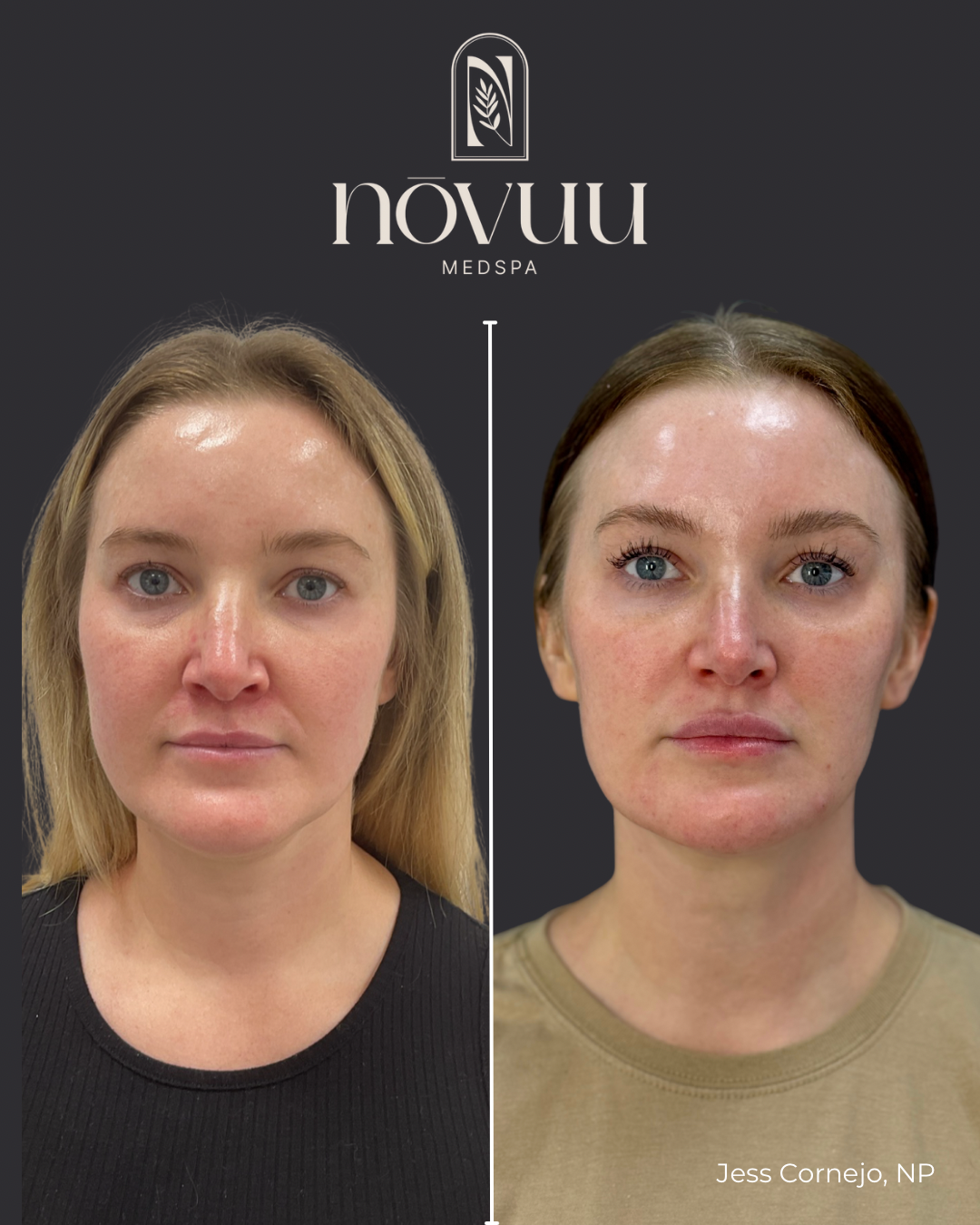 Copy of Medical weight loss