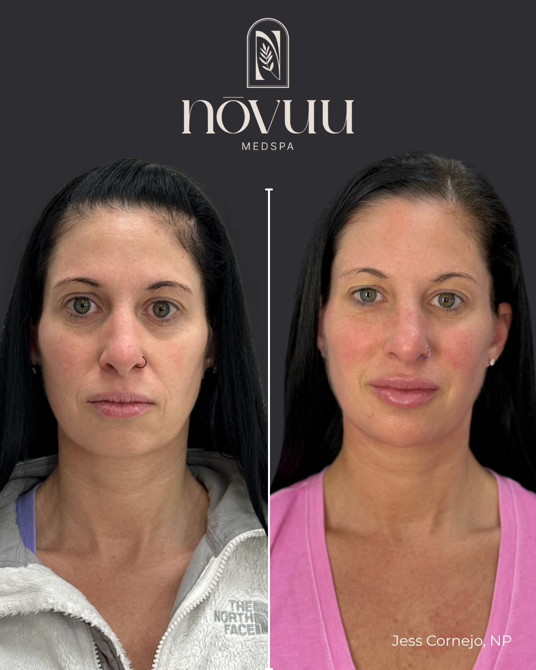 Copy of Medical weight loss.zip - 1