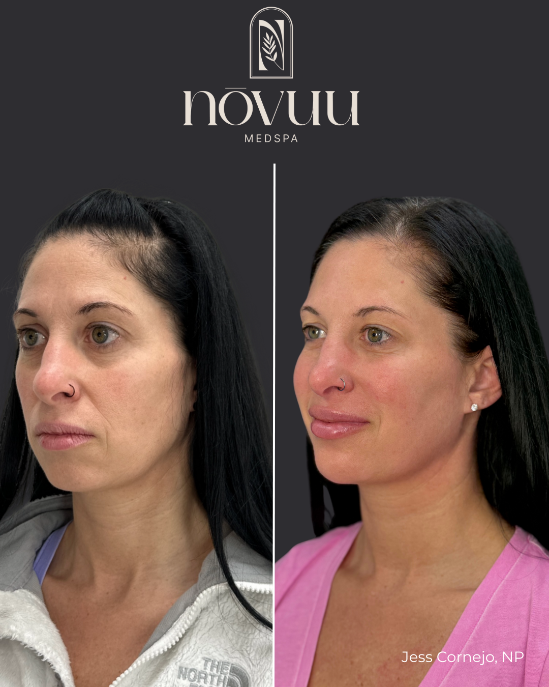 Copy of Medical weight loss.zip - 4