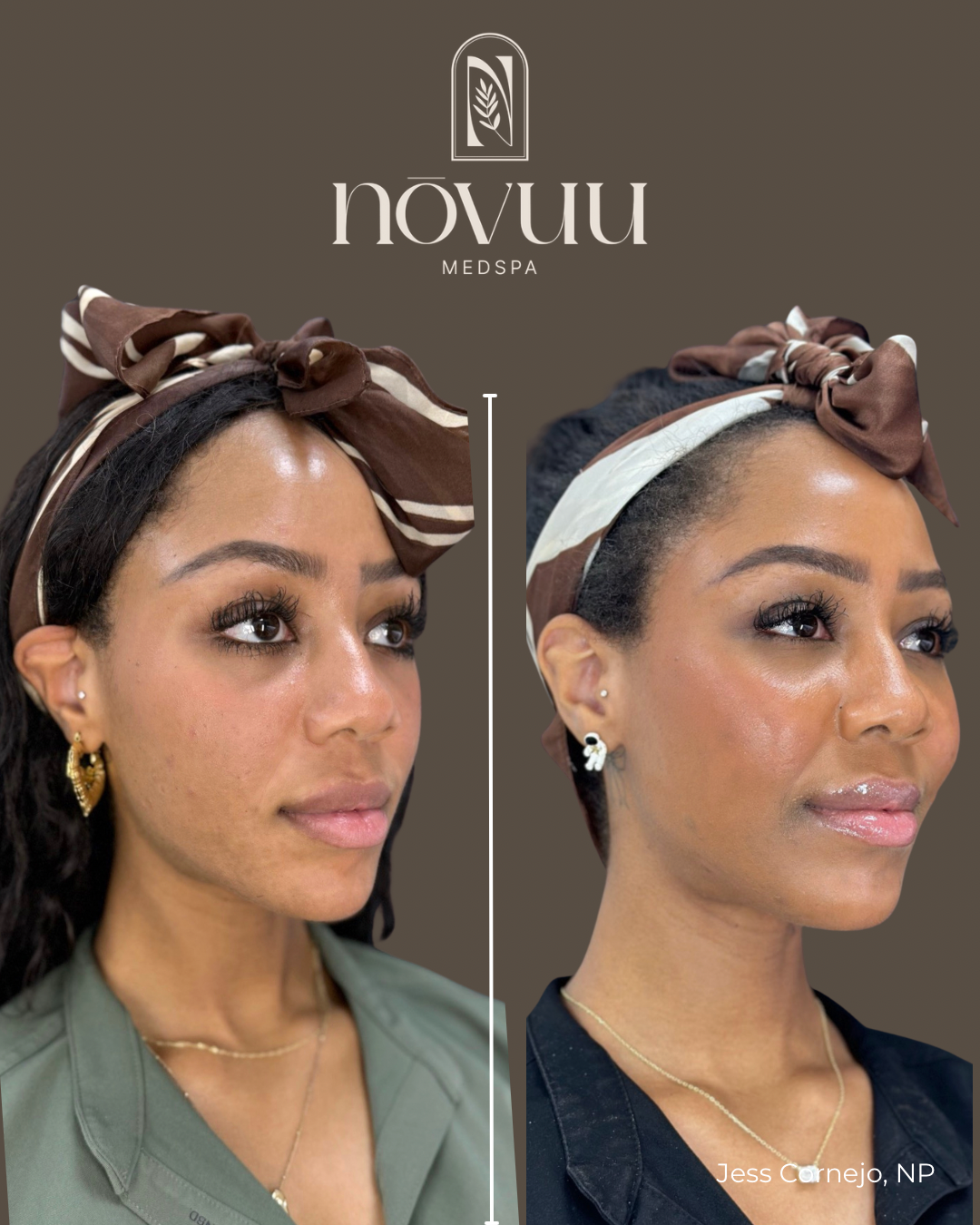 BEFORE & AFTERS - 11