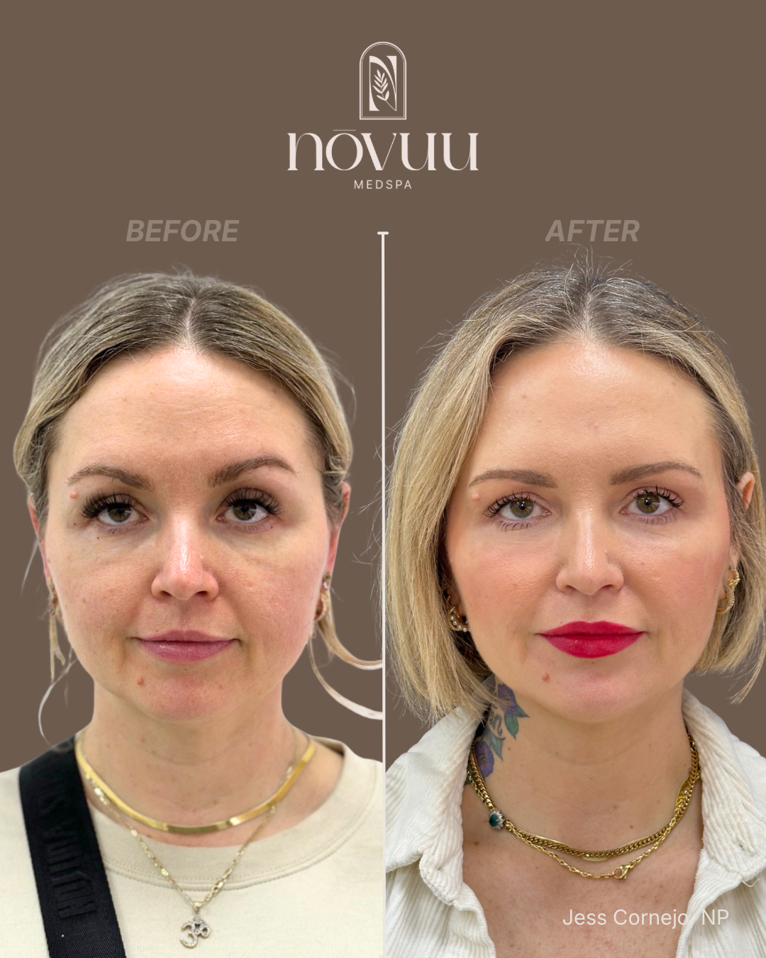 BEFORE & AFTERS - 15