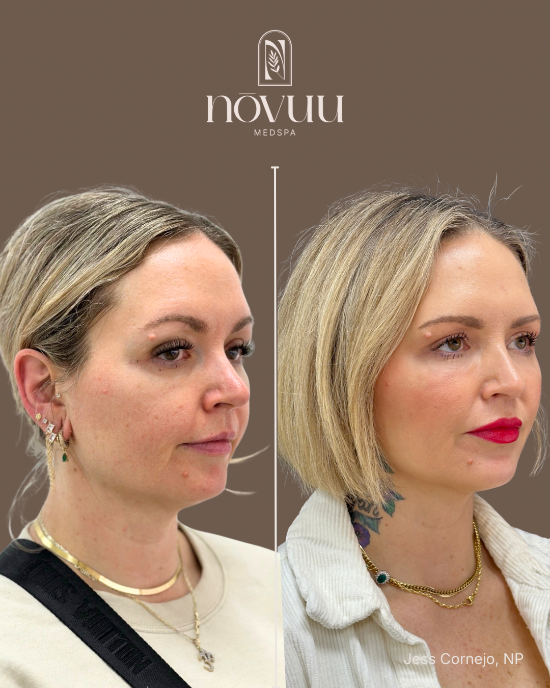 BEFORE & AFTERS - 17