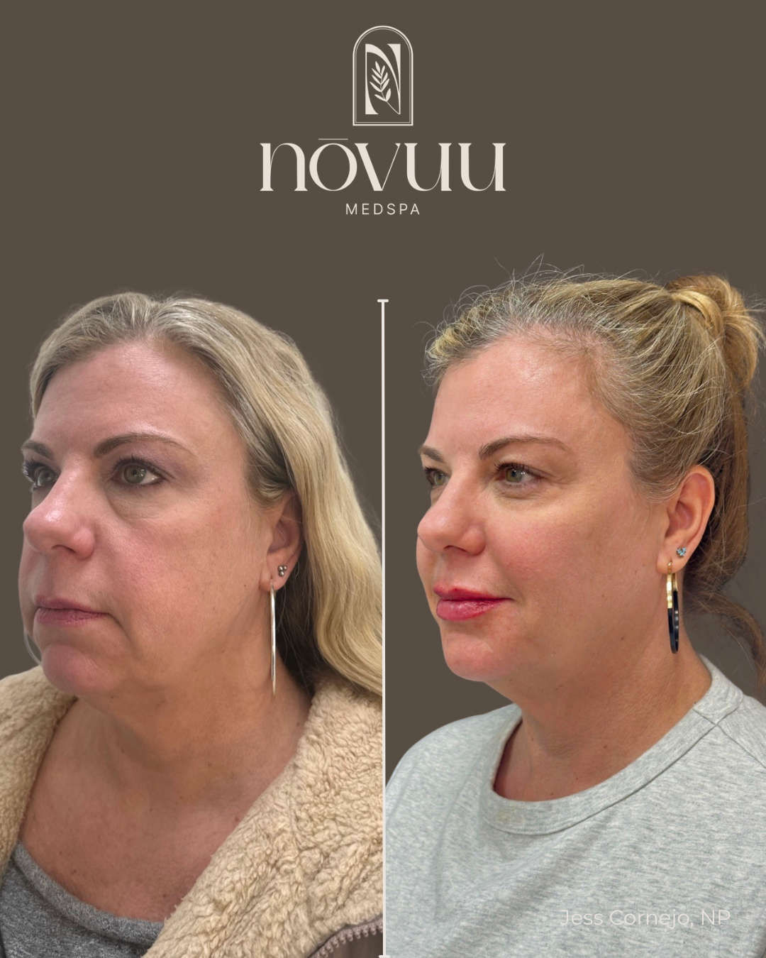 BEFORE & AFTERS - 24