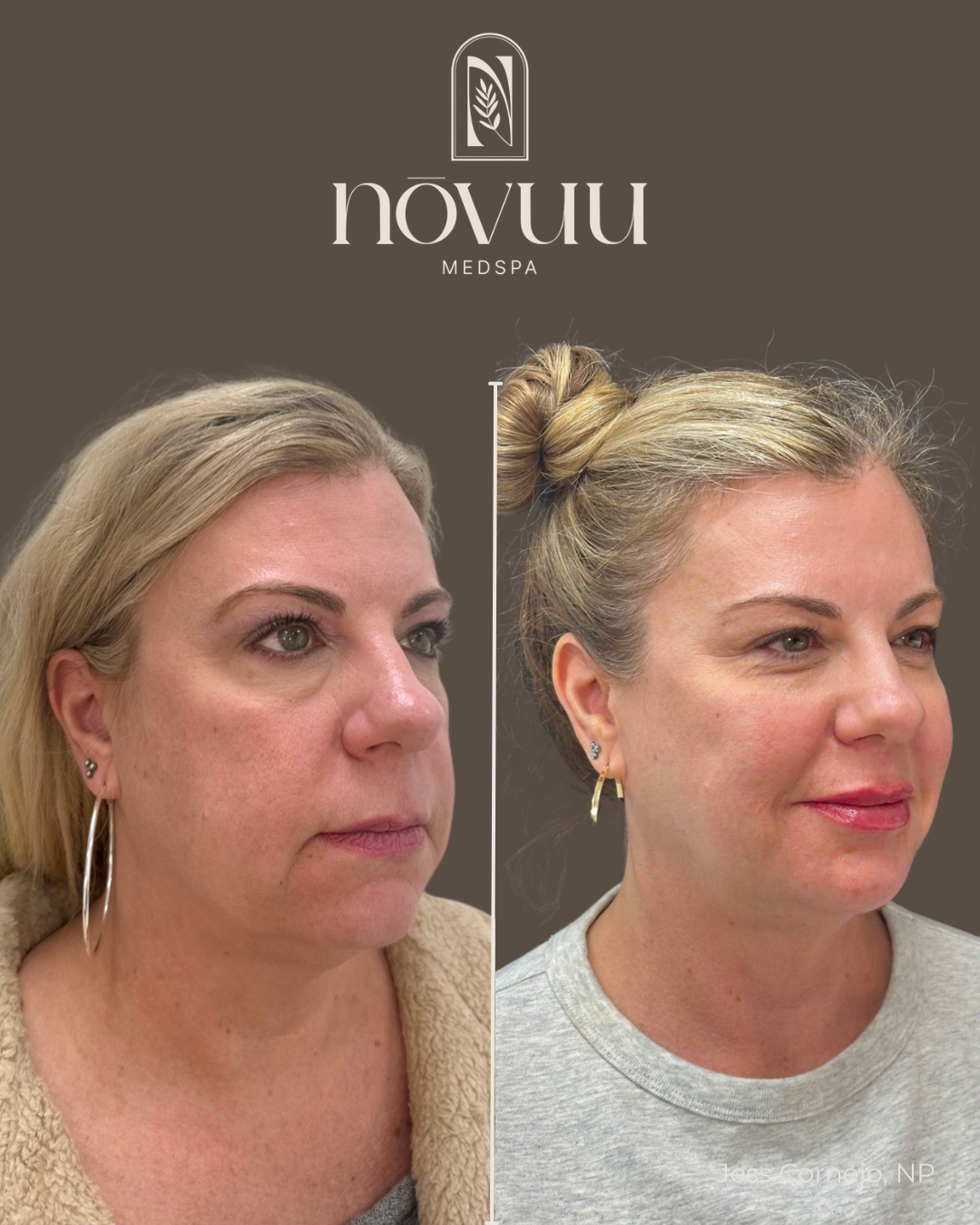 BEFORE & AFTERS - 25