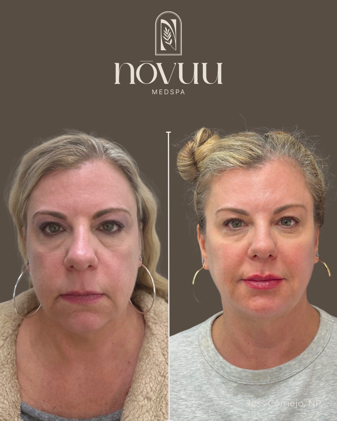 BEFORE & AFTERS - 26