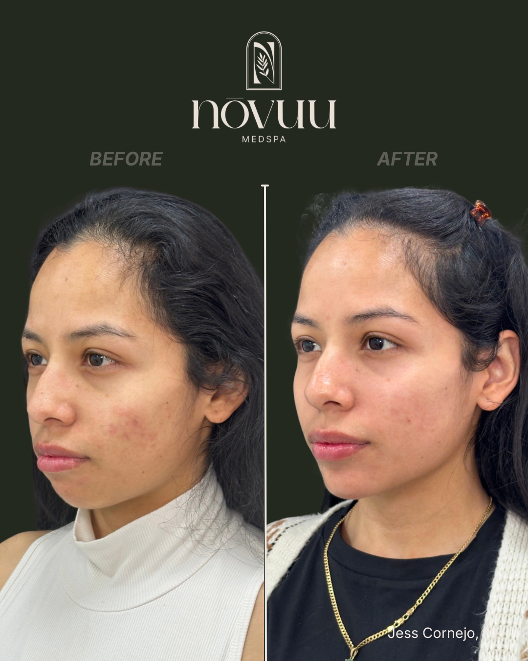 BEFORE & AFTERS - 34