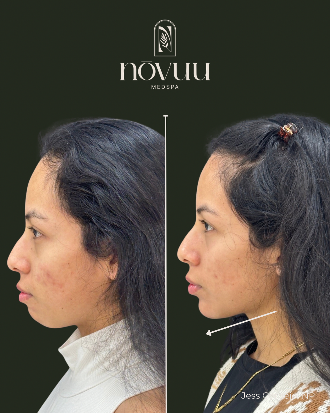 BEFORE & AFTERS - 36