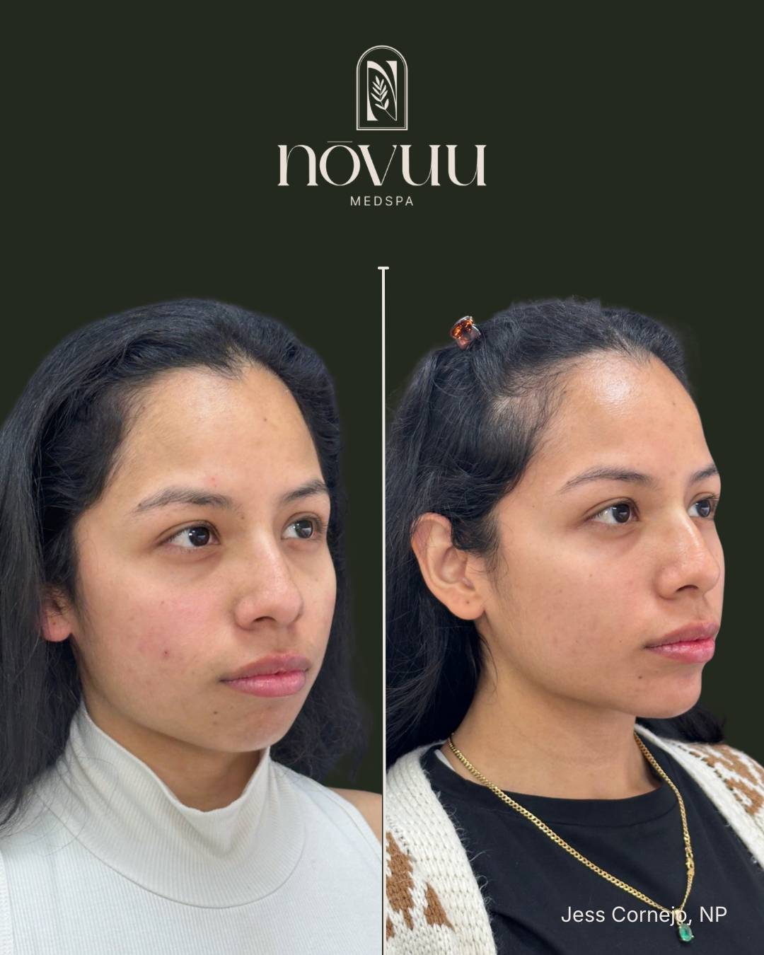 BEFORE & AFTERS - 37