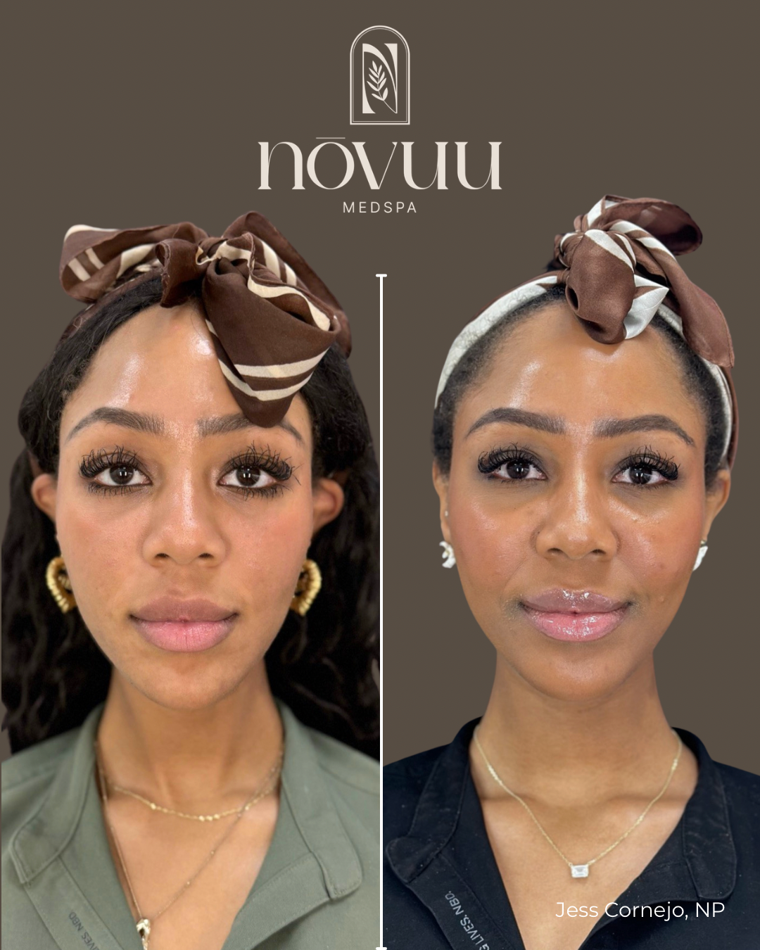 BEFORE & AFTERS - 6