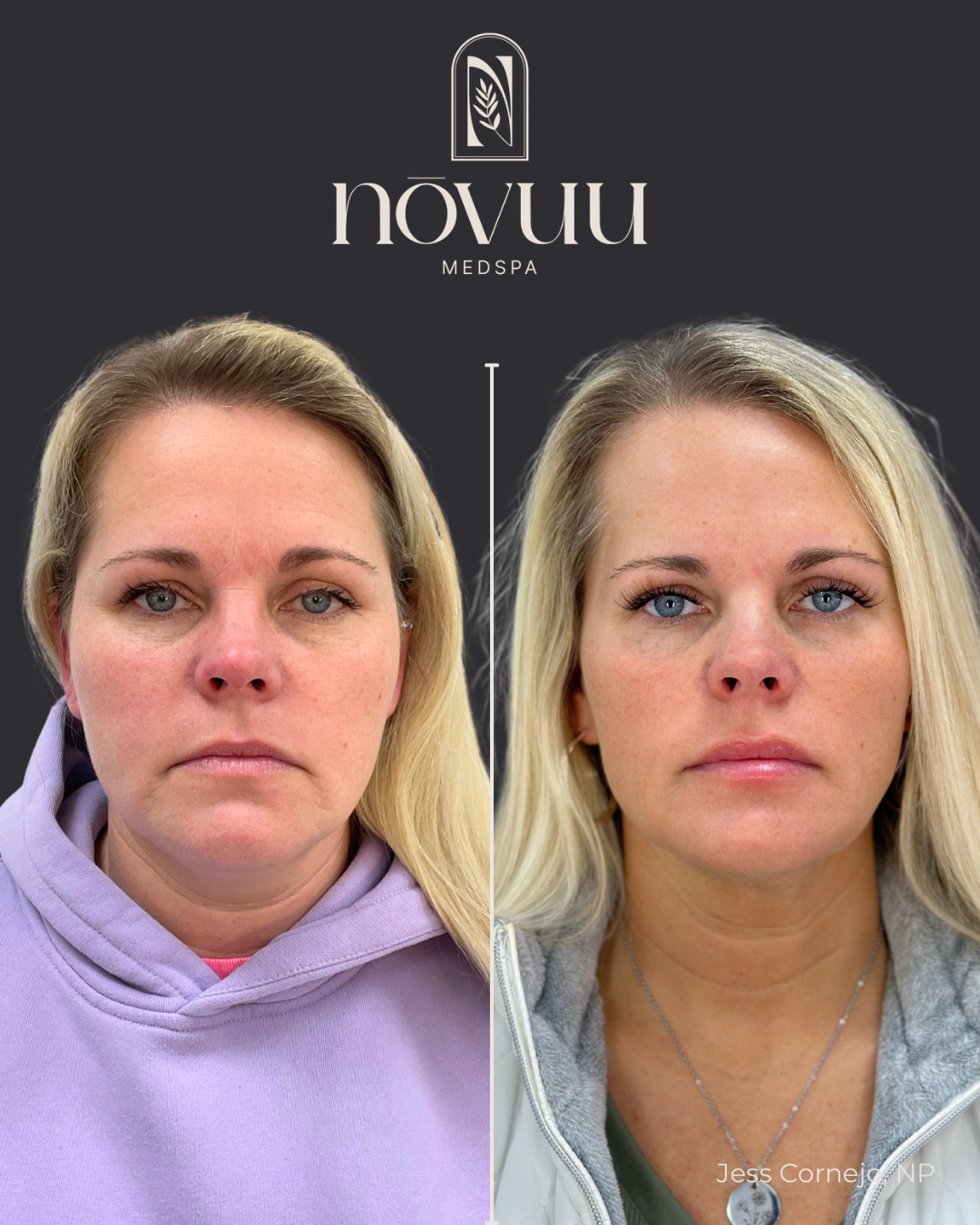 BEFORE & AFTERS - 72