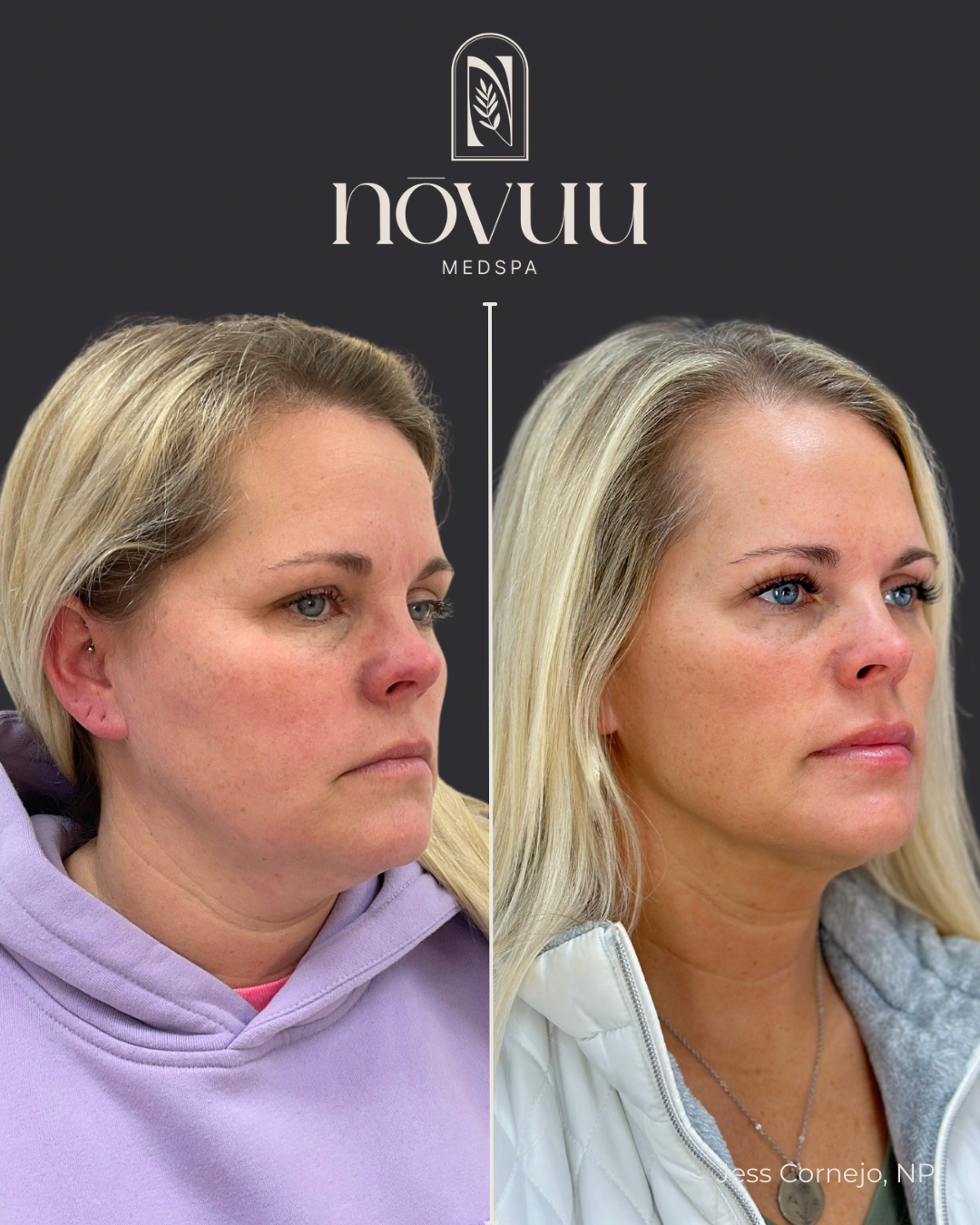 BEFORE & AFTERS - 76