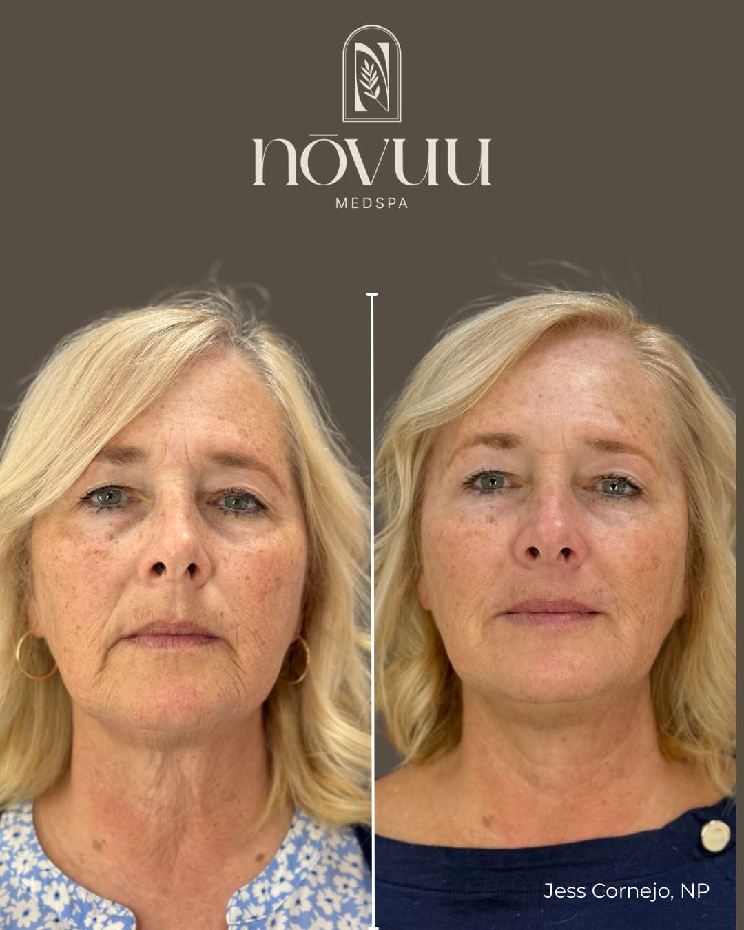BEFORE & AFTERS - 8